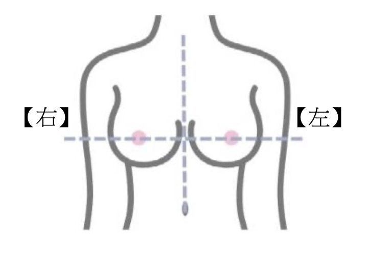 乳房檢查位置示意圖